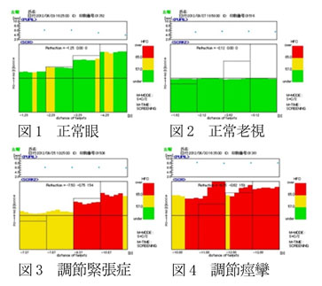 目の調節機能の測定結果