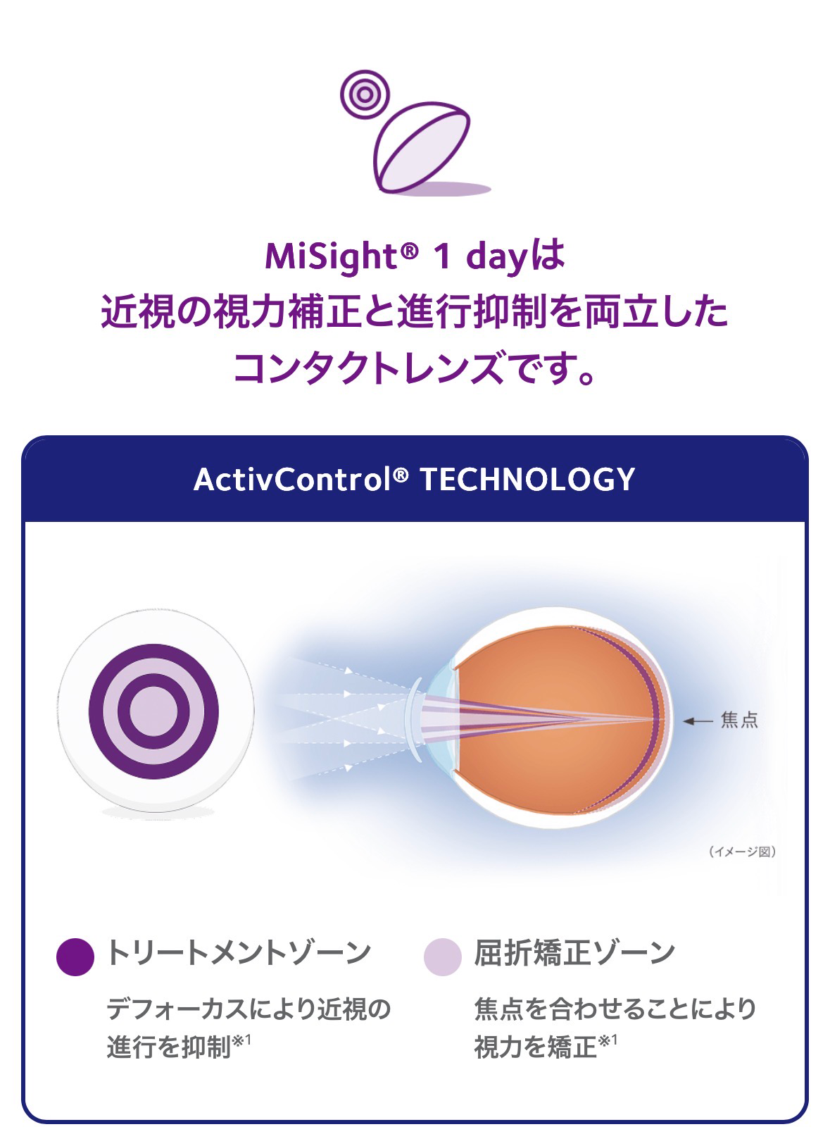 お子さまの近視進行が気になる方へ